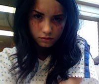 Demi Lovato en "Anatomía de Grey"