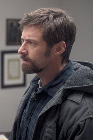 Hugh Jackman desvela que tiene una variedad leve de cáncer de piel