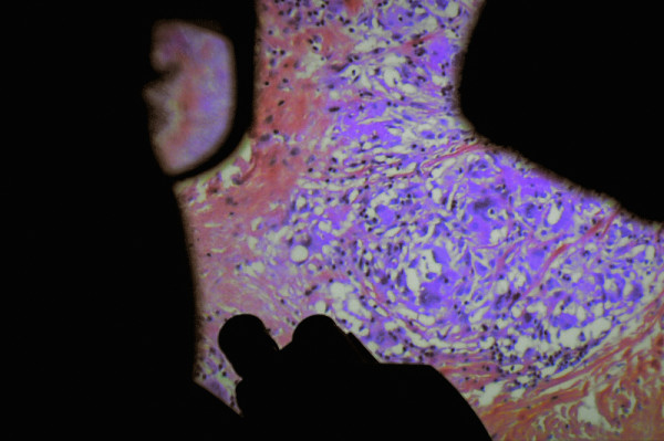 De Humani Corporis Fabrica foto crítica.