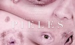 Pieles