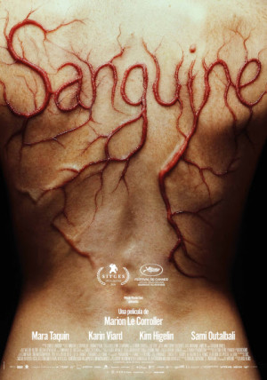 Sanguine